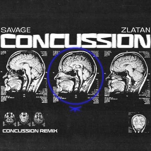 Savage – Concussion Remix ft. Zlatan